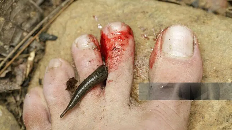 Mơ thấy đỉa cắn chảy máu